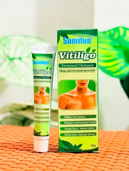 Sumifun Vitiligo Treatment Ointment